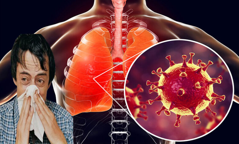 سندھ:کورونا انفلوئنزا کیسز،سپتالوں میں ایمرجنسی 1 Influenza 1